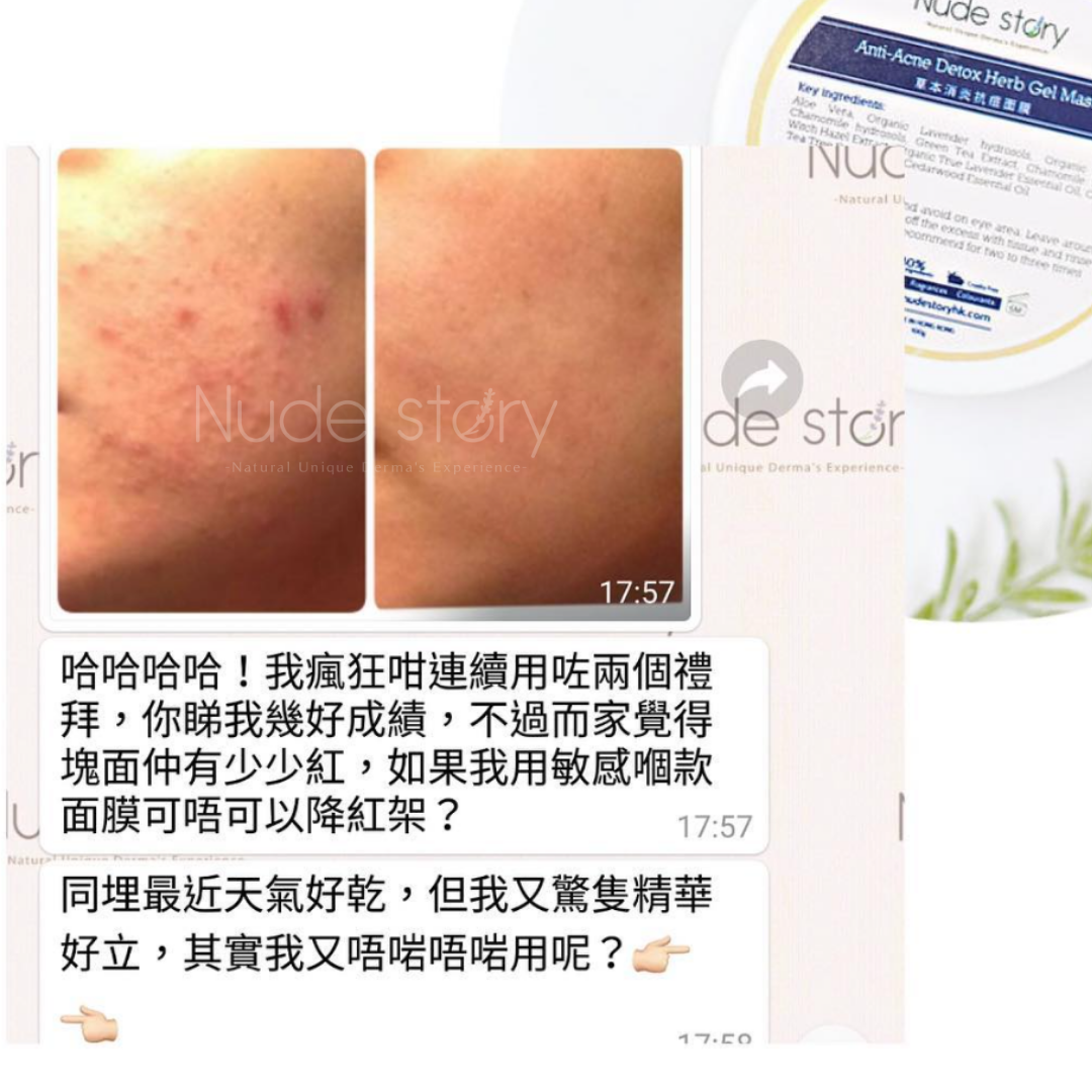 暗瘡｜暗瘡印｜acnes ｜暗瘡肌膚