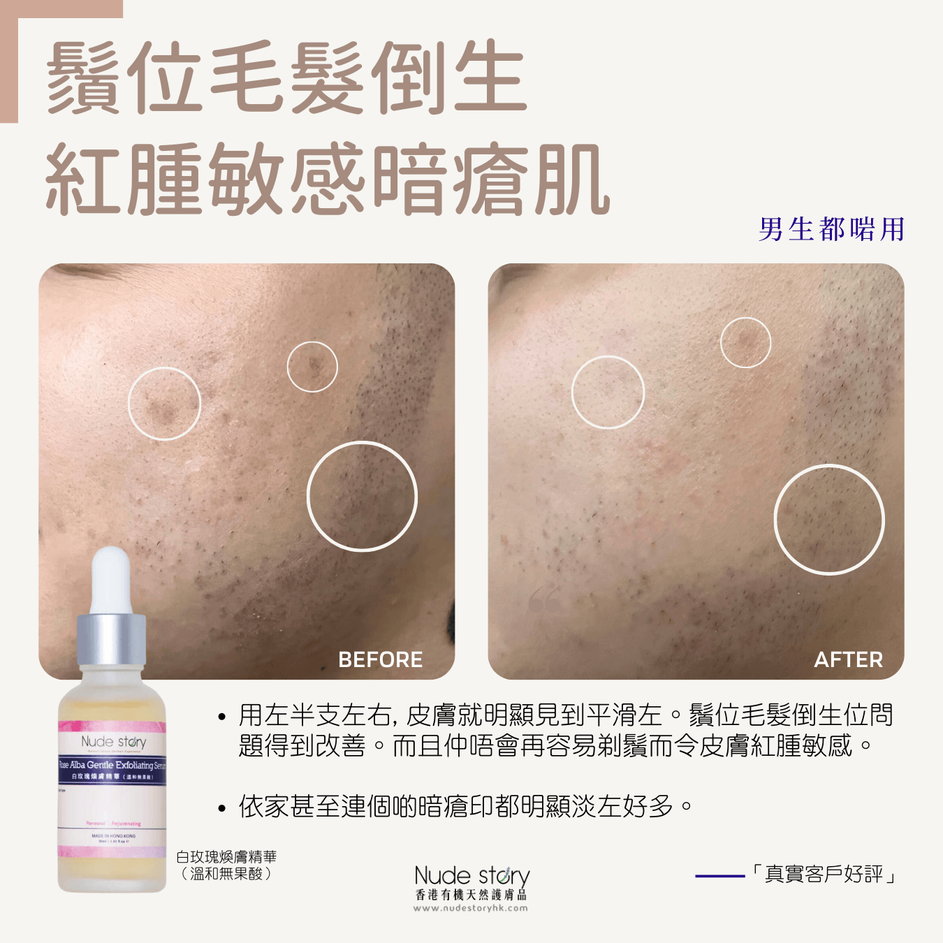 白玫瑰煥膚精華（溫和無果酸）